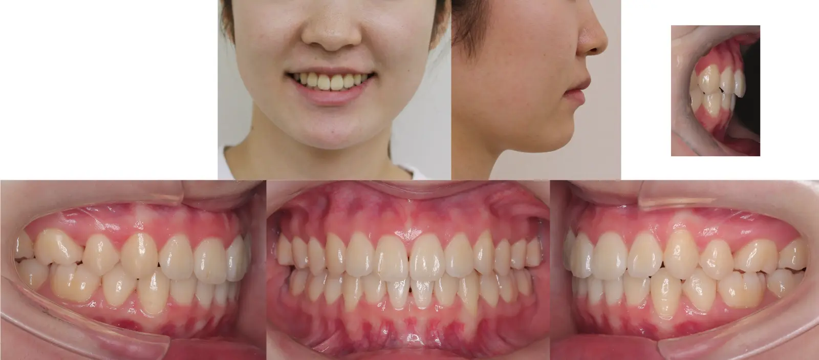 治療2年7ヶ月後